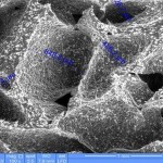 Sintetinis kaulo pakaitalas