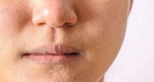 Dermatologė: „Sausas oras patalpose spartina odos senėjimą“